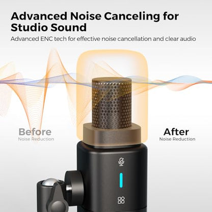 NearStream AM25X Gen3 USB/XLR Podcast Microphone for PC/Audio Mixer | Condenser Mic with Desk Stand for for Stream/Podcast, USB-C Noise Canceling, Volume, Headphone Jack, Mute; XLR for Mixer