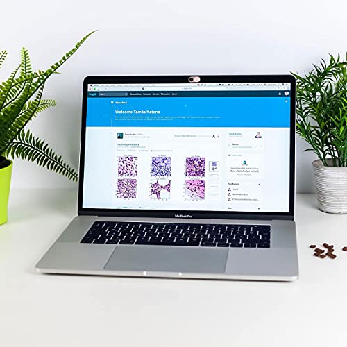 CloudValley Camera Cover Slide Ultra-Thin, Webcam Cover for MacBook air, Laptop, iMac, Desktop, PC, MacBook Pro, iPad, iPhone 8/7/6, Privacy Web Camera Protection [2 Packs], Pink - color: Pink-2 Pcs